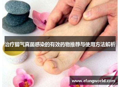 治疗脚气真菌感染的有效药物推荐与使用方法解析